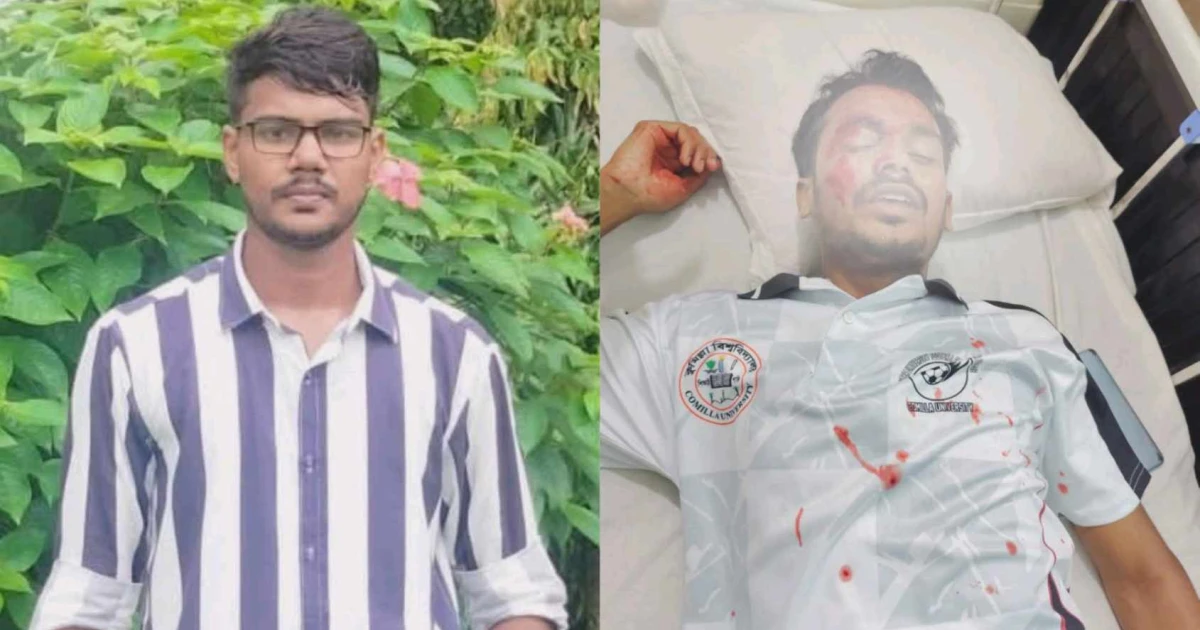 সহপাঠীর হামলায় রক্তাক্ত কুবি শিক্ষার্থী, ঘটনার তদন্তে প্রশাসন
